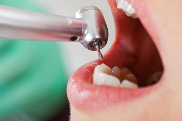 Best Emergency Dental Care for Abscessed Tooth in Sheridan, AR